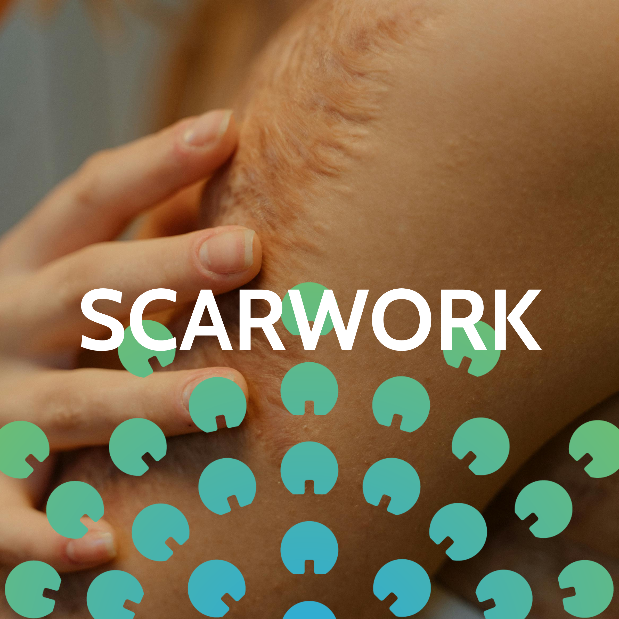 SCARWORK